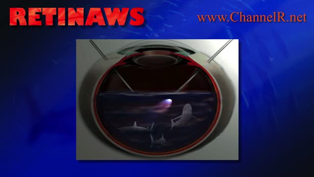 Retinaws PAAO Bogota