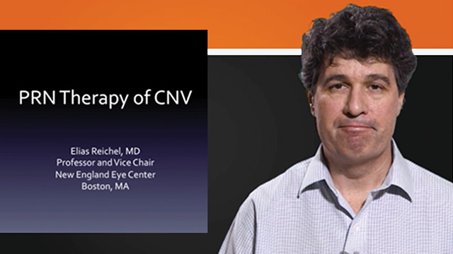 PRN Therapy for Treatment of CNV