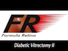 Diabetic Vitrectomy II