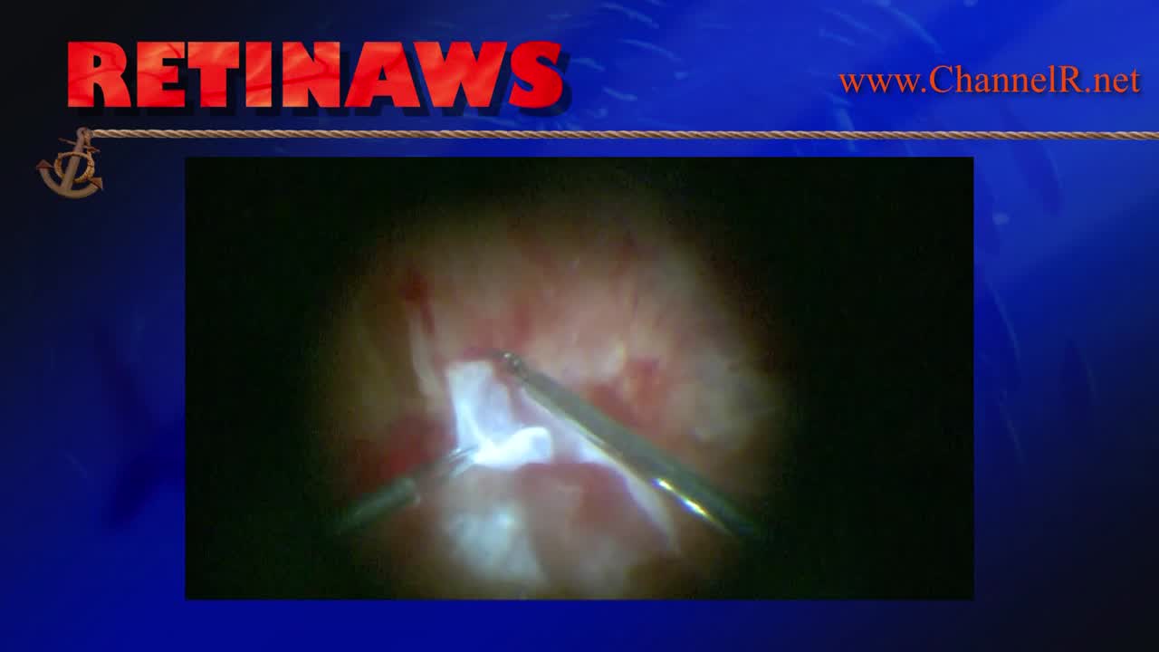 Thumbnail for jcfil