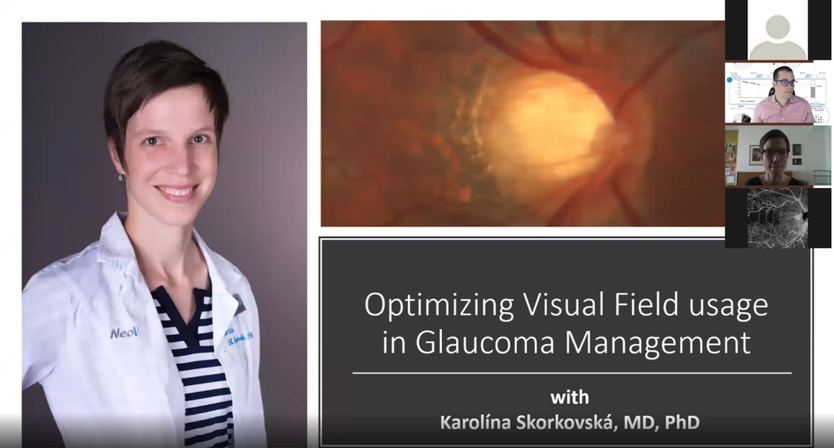 Optimizing Visual Field usage in Glaucoma Management