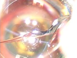 Instrumentation Headaches - Part 1