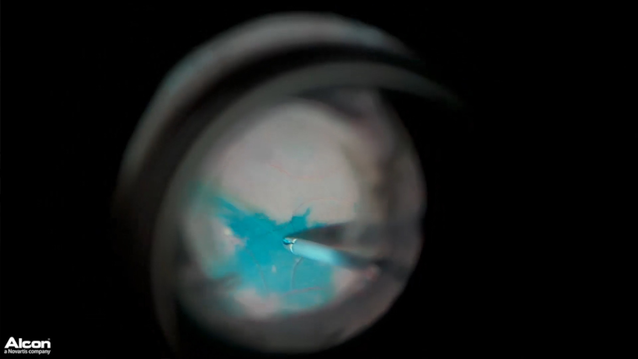 Extended Depth of Field/ High Magnification Performance (3D)