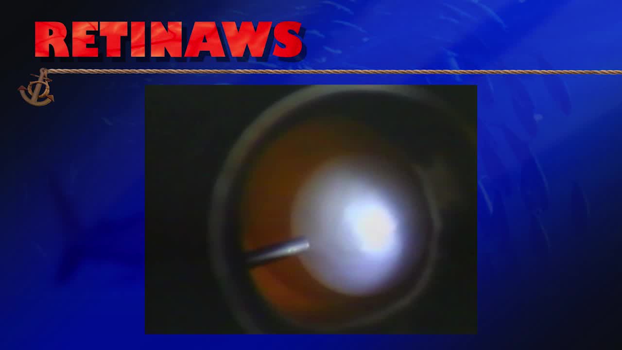 Thumbnail for jnsiv