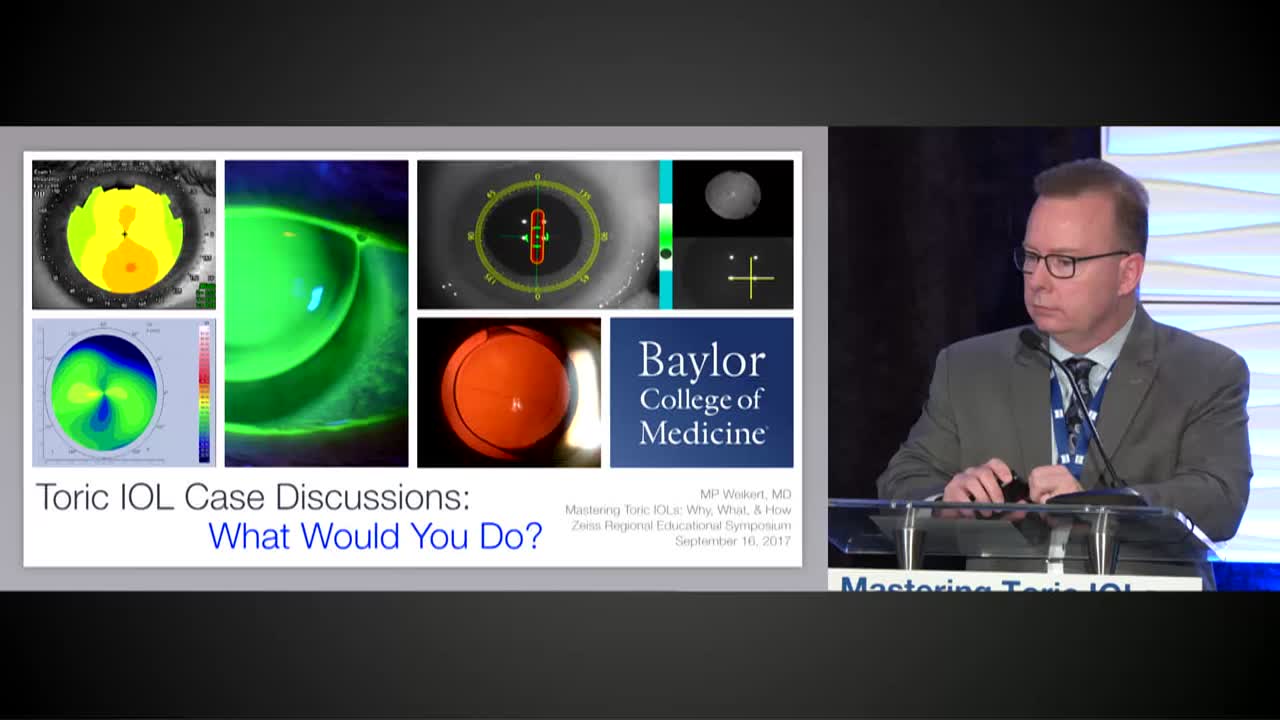 Toric IOL Case Discussions