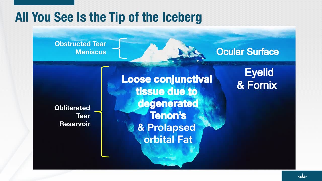 Addressing Mechanically Induced Dry Eye