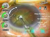 Ellips Transversal Phaco Through 2.2mm Incision