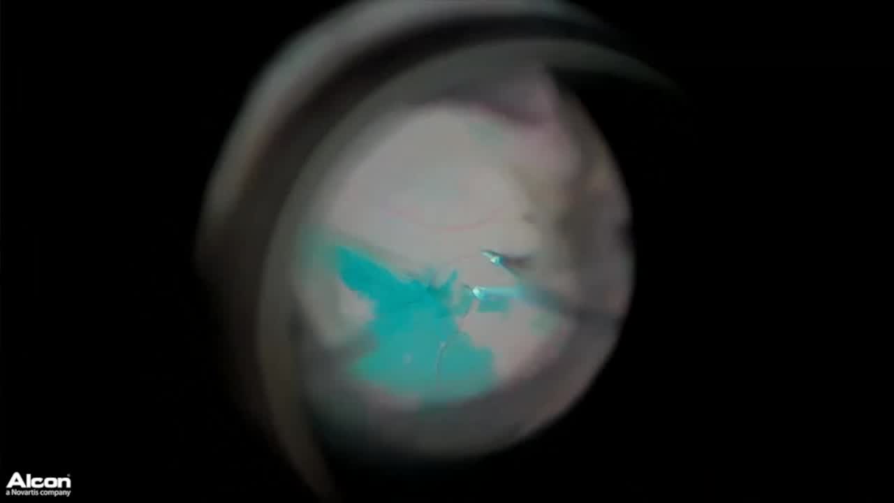 Extended Depth of Field/High Magnification Performance