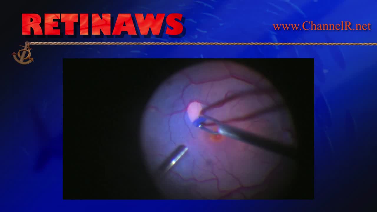 Thumbnail for jwyaf