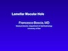 Lamellar Macular Hole
