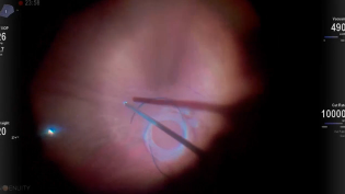 Shaolin Retina: Yamane in 3D 