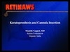 Keratoprosthesis and Cannula Insertion