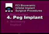 Peg Implant