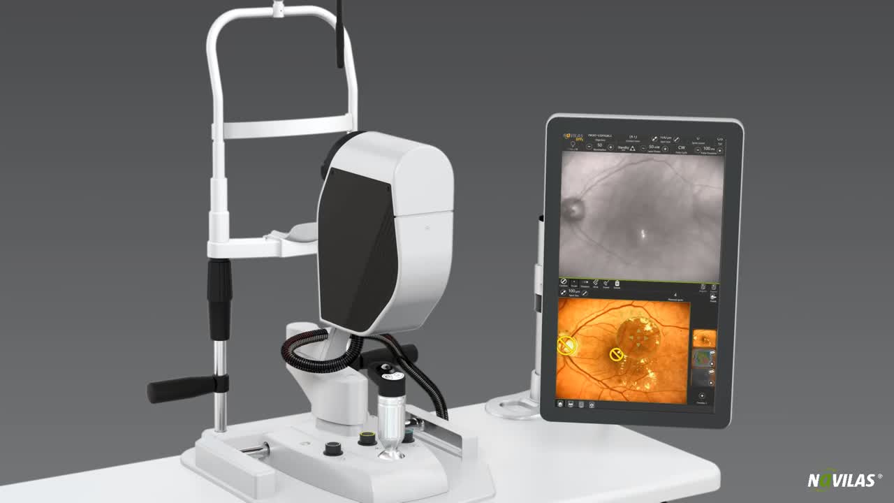 A video introduction to navigated retinal laser therapy with Navilas 577s