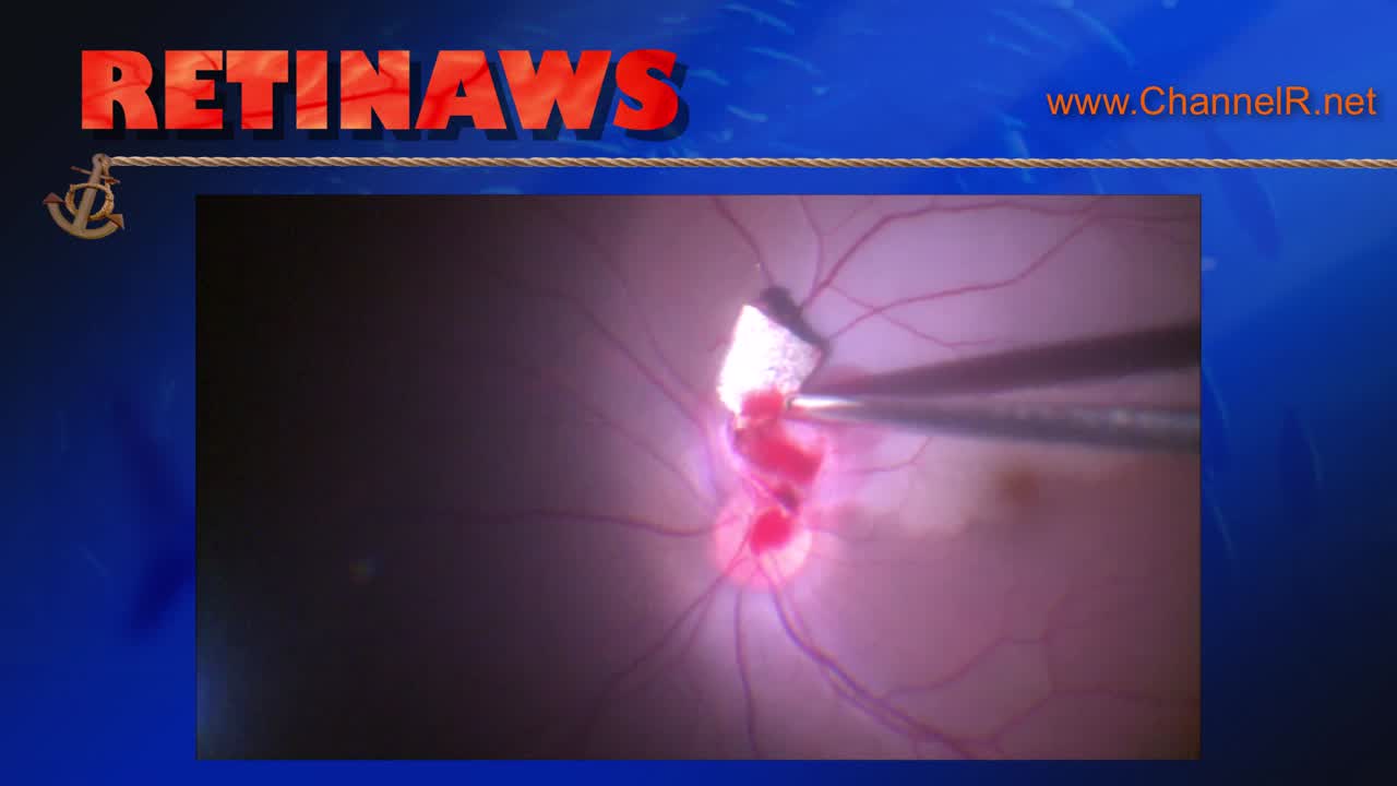 Thumbnail for kslib