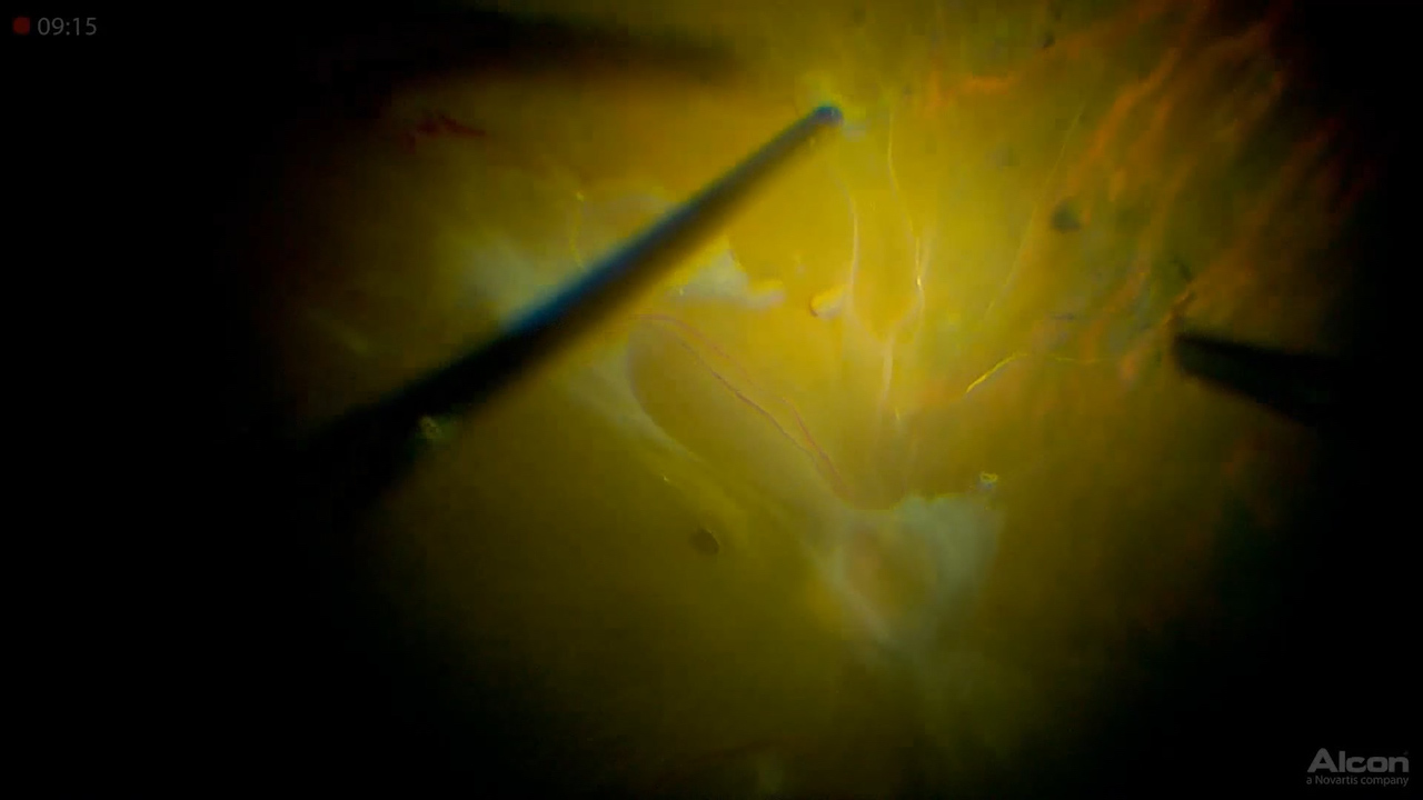 High Magnification Performance (3D)