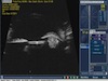 UBM Plus Case 1