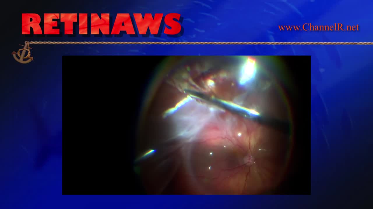 Thumbnail for kvhej