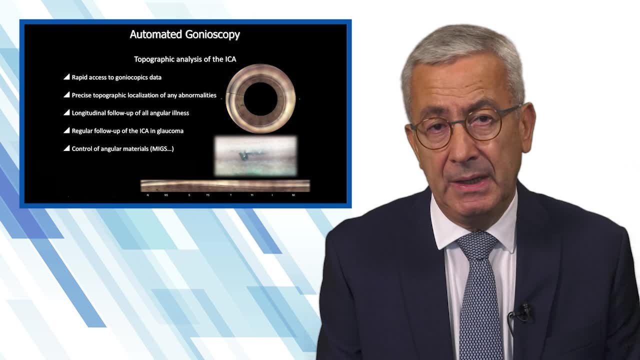 Advantages of Automated Gonioscopy