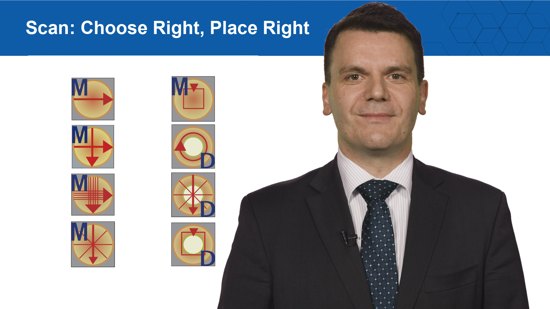 SD-OCT & OCT-A Scans