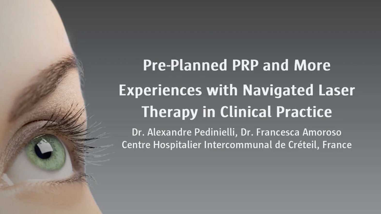 Pre-Planned PRP and More Experiences with Navigated Laser Therapy in Clinical Practice