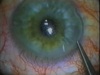 Eyelash!
