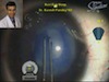 Pearls for Management of Infantile Cataract
