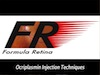  Ocriplasmin Injection Techniques