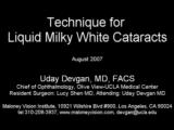 Technique for Liquid Milky White Cataracts