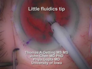 Little Fluidics Tip