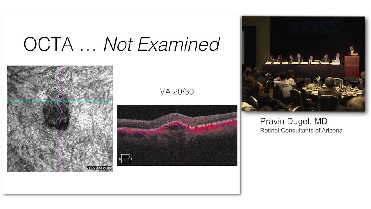 OCT-A: Implications for Detection of CNV Prior to Recurrence
