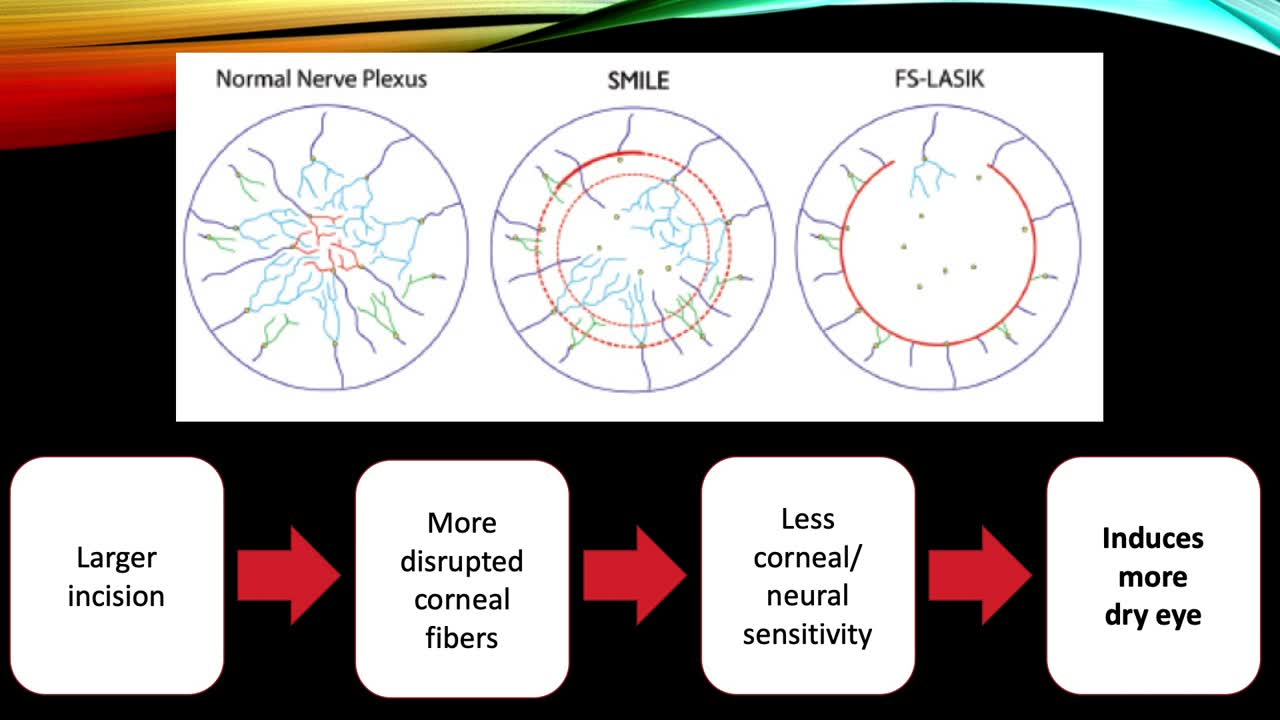 Taking Corneal Considerations to the Next Level