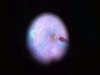 Techniques in Vitreoretinal Surgery: Macular Hole Surgery