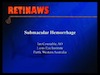 Submacular Hemorrage