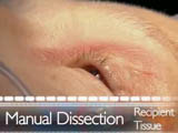 IEK: Manual Dissection of Recipient Tissue