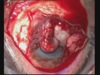 Ocular Surface Disorders - An Overview