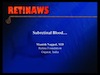 Subretinal Blood