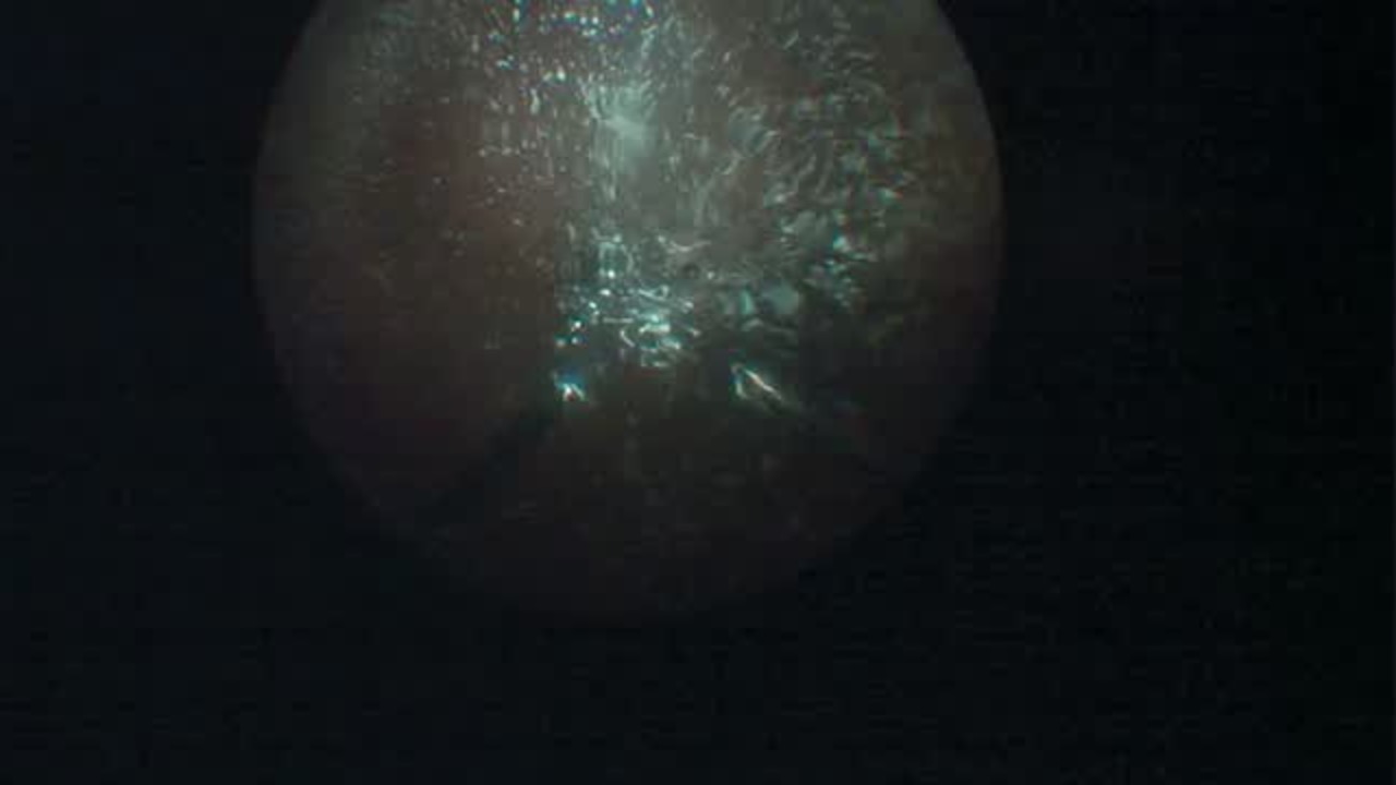 Ngenuity Visualization Through Suboptimal Media