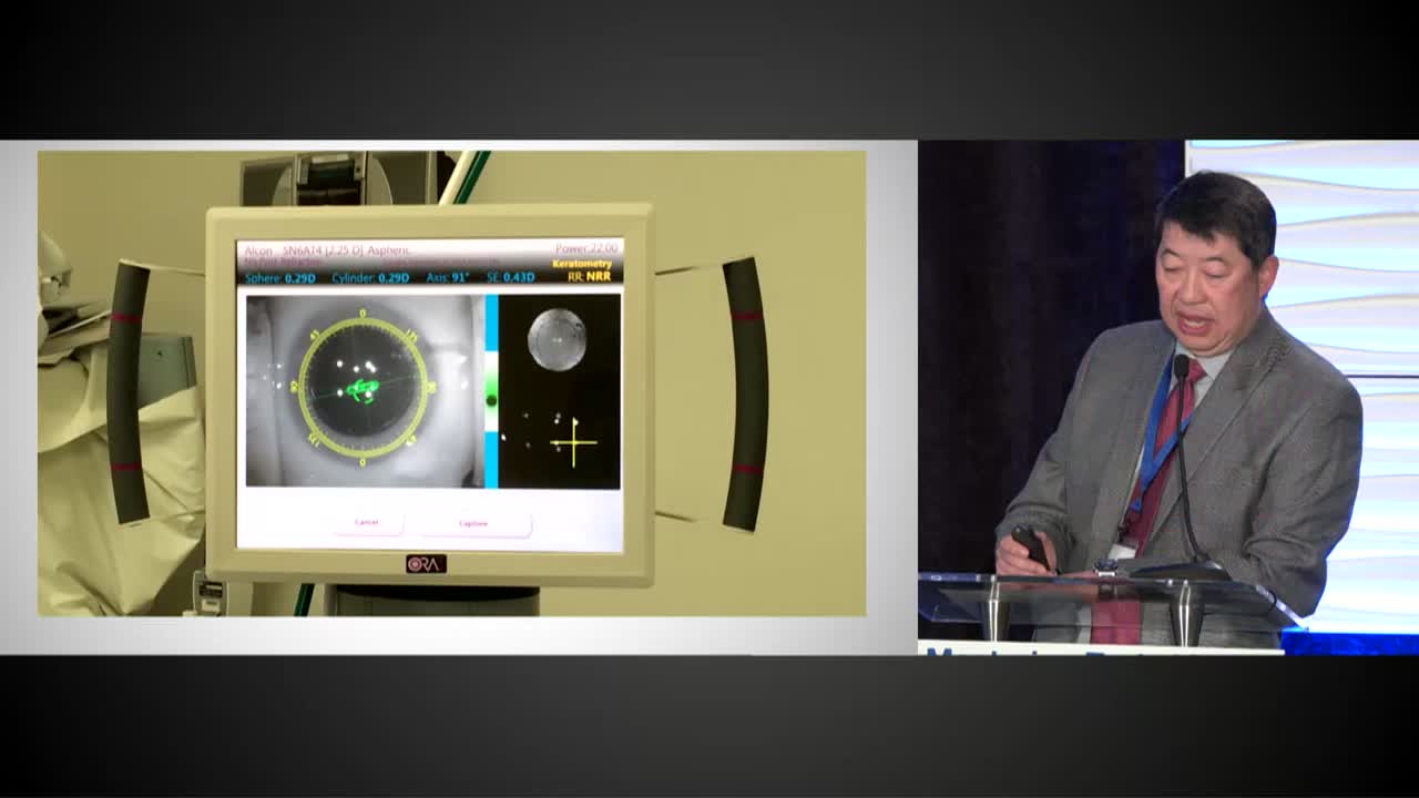 Intraoperative Aberrometry Clinical Utility
