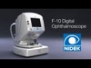 F-10 Scanning Laser Ophthalmoscope 