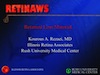 Retained Lens Material