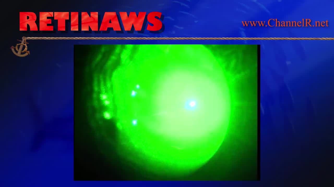 Thumbnail for lvwam