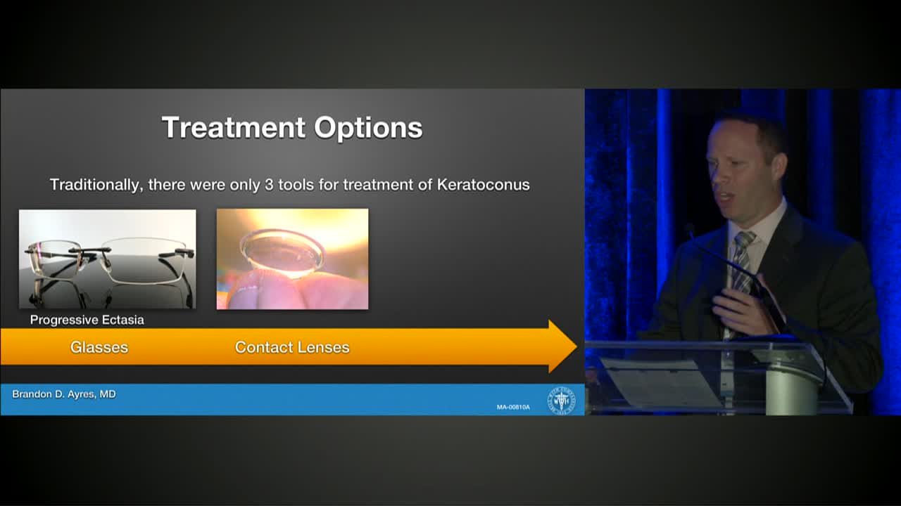 Educating and Treating the Keratoconus Patient
