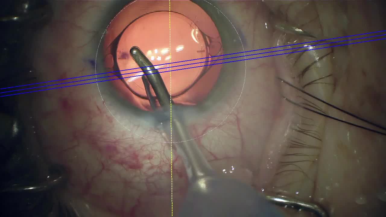 Utilizing Technology to Maximize Intraoperative Accuracy