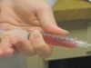In-Office Vitrectomy with Portable Vitreous Cutter