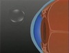 The Low Low Myope - Part 2