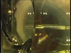 High Frequency Deep Sclerotomy Ab Interno