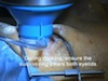  Femtosecond Laser Plus Premium IOLs