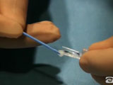 Toric ICL Implantation