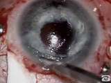 The Eye with Three Lenses: A Modern Horror Story